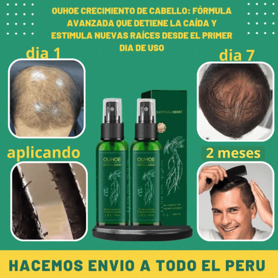 OUHOE Crecimiento de Cabello: El Producto Ideal para Combatir la Caída y Mejorar la Fuerza Capilar