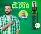 OUHOE Crecimiento de Cabello: El Producto Ideal para Combatir la Caída y Mejorar la Fuerza Capilar